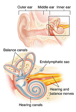 Cross section of ear showing outer, middle, and inner ear with closeup of cochlea