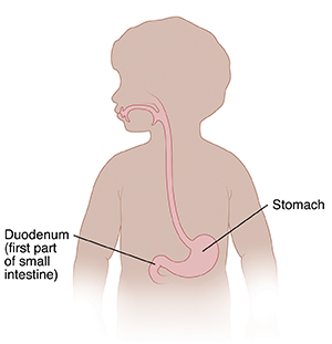 Outline of child with location of stomach and duodenum.