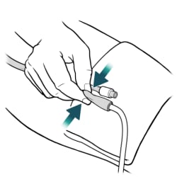Hand holding catheter, with thumb and index finger pinching catheter.