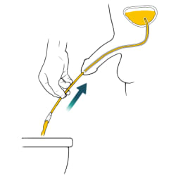 Person holding catheter, with arrow showing person pushing catheter into penis and urine flowing through catheter into toilet.