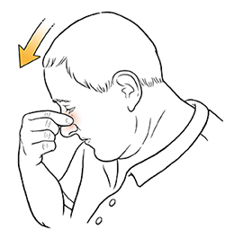 Man leaning head forward and pinching nose.