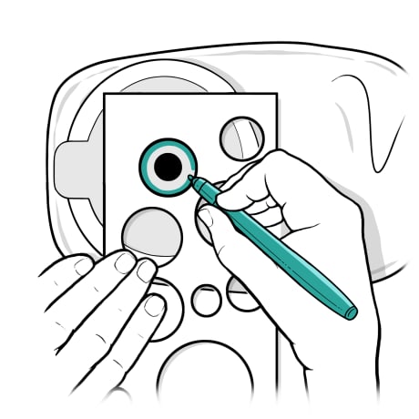 Person using pen to mark front of ostomy bag skin barrier with measuring guide.