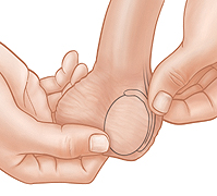 Closeup of hands checking epididymis during testicular self-exam.