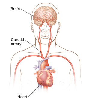 Front view of head and upper body showing carotid arteries, heart, and brain.