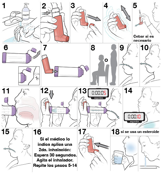 17 pasos para usar un inhalador de dosis medida con espaciador