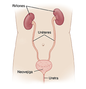 Vista delantera de un torso masculino, donde pueden verse los riñones conectados a la vejiga nueva mediante los uréteres. La vejiga nueva se conecta a la uretra.