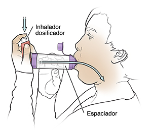 Mujer que usa un inhalador de dosis medida con un espaciador.