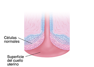 Corte transversal del cuello uterino, donde se observan células normales.