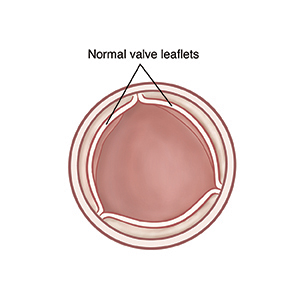 Top view of open aortic valve with normal leaflets.