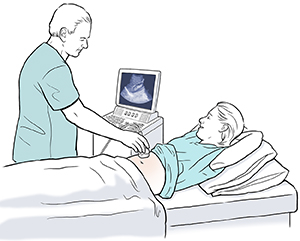 Woman lying on exam table. Healthcare provider is holding ultrasound transducer to woman’s abdomen and looking at image on monitor.